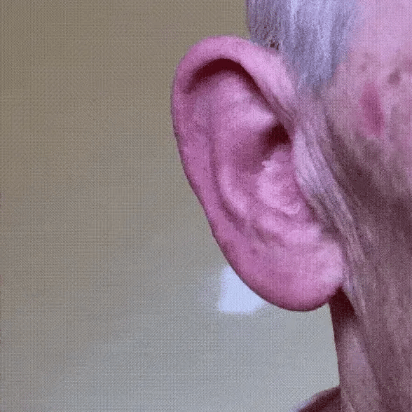 Discreet and Comfortable – All-Day Wear Without Noticing
