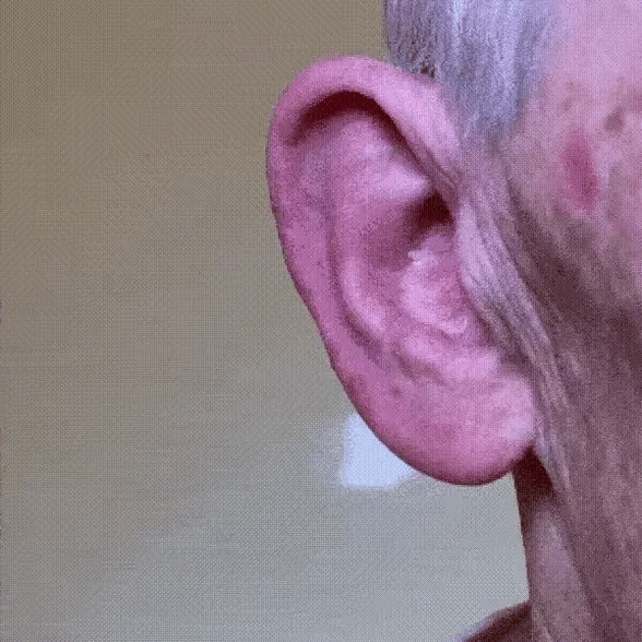 Discreet hearing aid fit